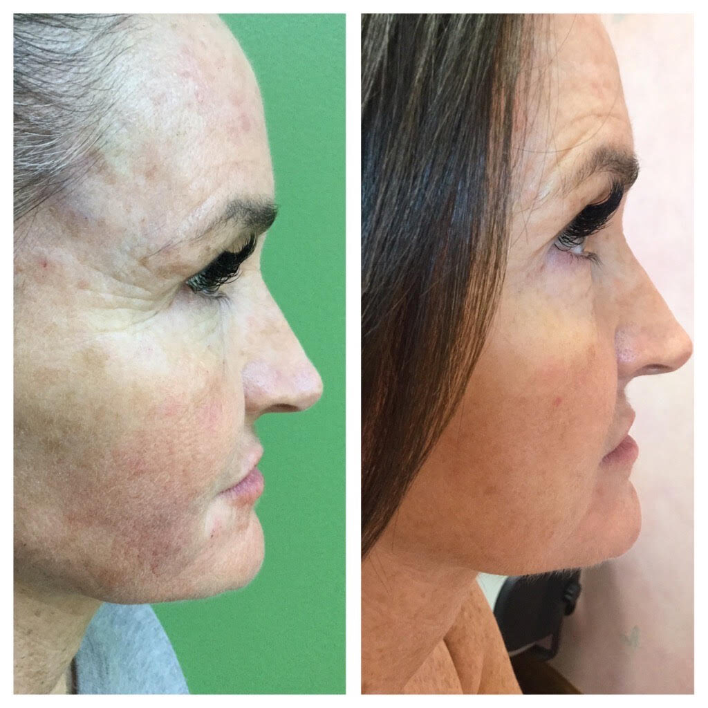 Dermatologist Cincinnati – Dr. Porras Skin Diagnostics Laser and  Rejuvenation