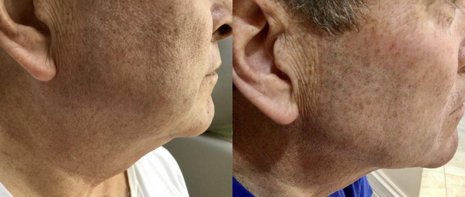 Dermatologist Cincinnati Dr. Porras Skin Diagnostics Laser and