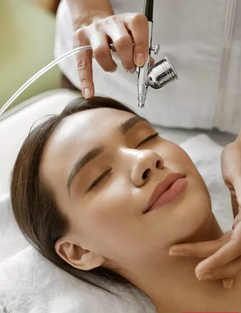microneedling with radiofrequency examples