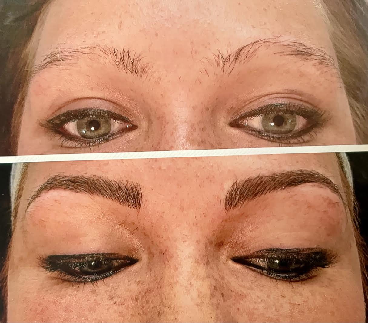 Dermatologist Cincinnati Dr. Porras Skin Diagnostics Laser and